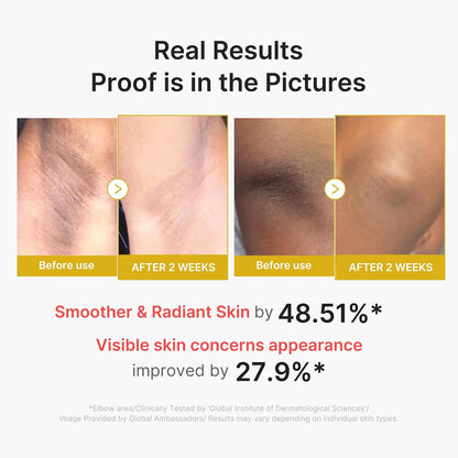 medicube Body Peel Shot Duo - Hypochlorous Acid & Kojic Acid Body Peel Shot